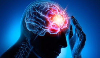 Epilepsi İle İlgili Bilmeniz Gereken 10 Gerçek
